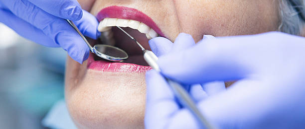 Best Dental Abscess Treatment in Perkins, OK